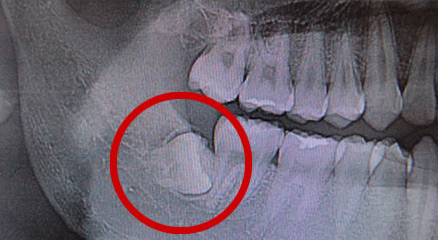 歯科口腔外科_1
